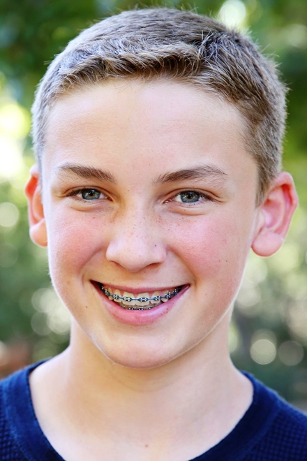 Braces Boy Smiling